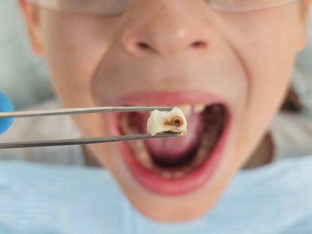 Best Knocked-Out Tooth Emergency  in Port Washington North, NY