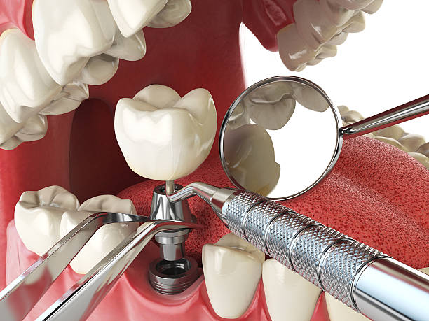 Best Cracked Tooth Emergency Dentist  in Port Washington North, NY